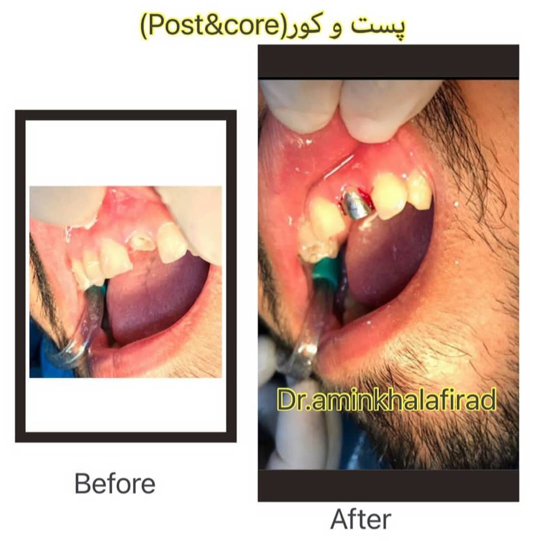 مطب دندانپزشکی دکتر امین خلفی راد در دزفول